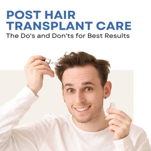 Caring for Transplanted Hair | Recovery Tips and Advice