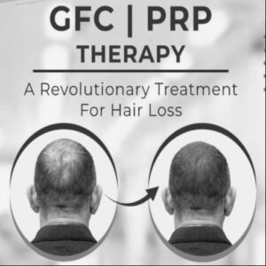 GFC vs PRP Treatment in Coimbatore: Which is More Effective