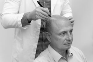 Hair Loss Prevention: How PRP and GFC Treatments in Coimbatore Can Help