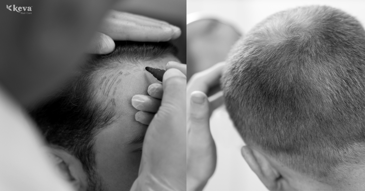 Hair Technology