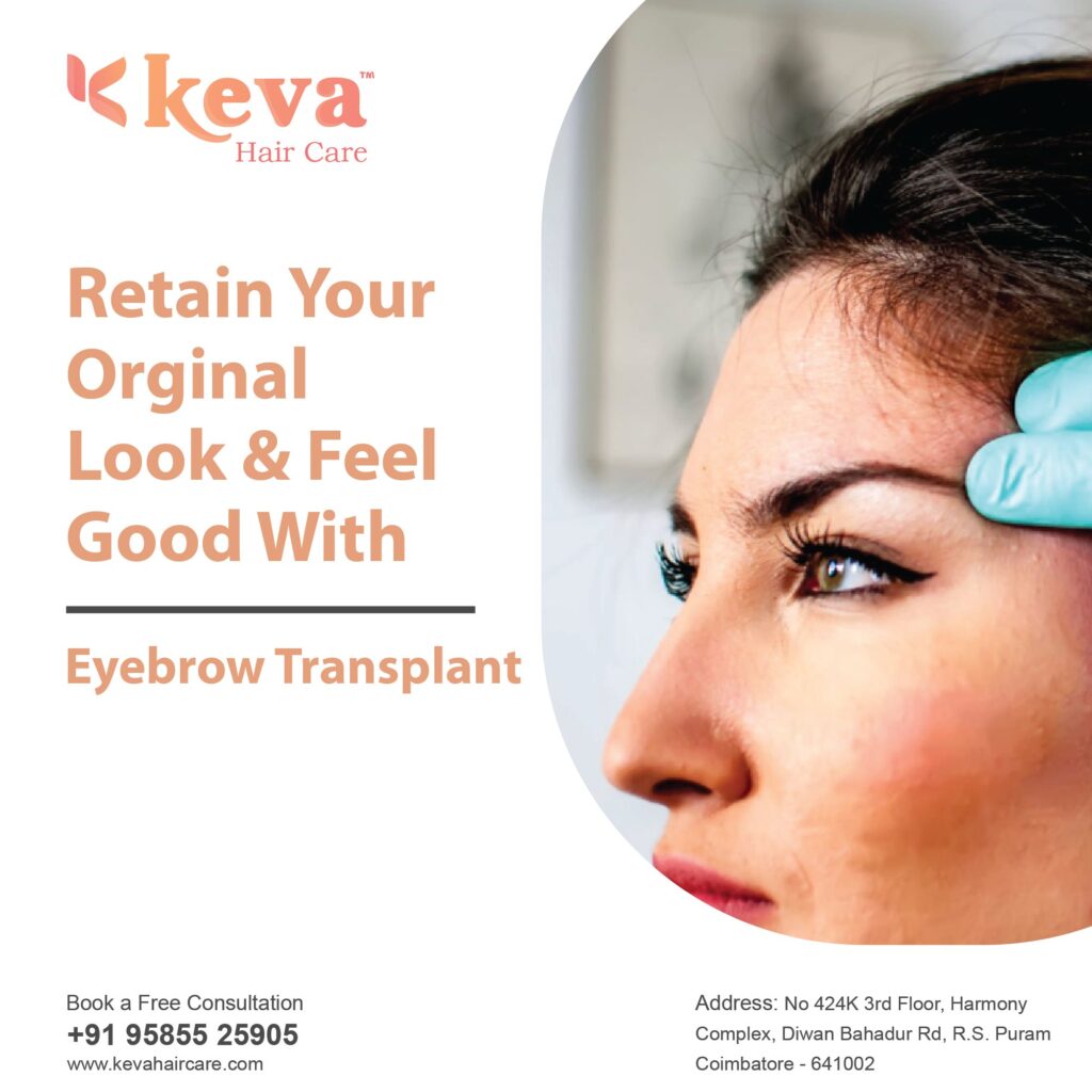Eyebrow hair transplant