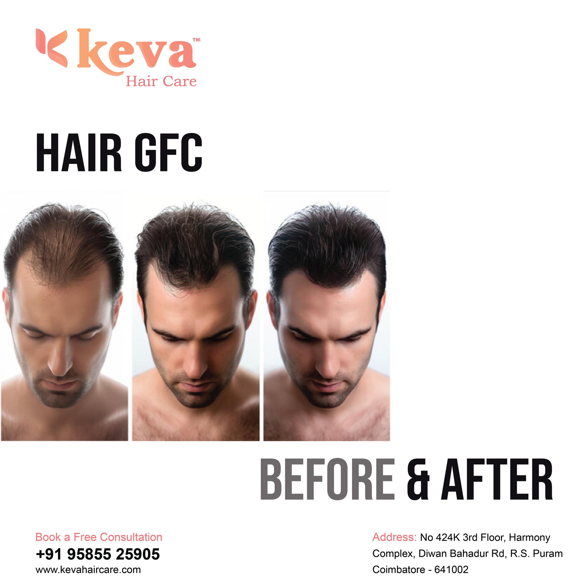 GFC Hair Treatment