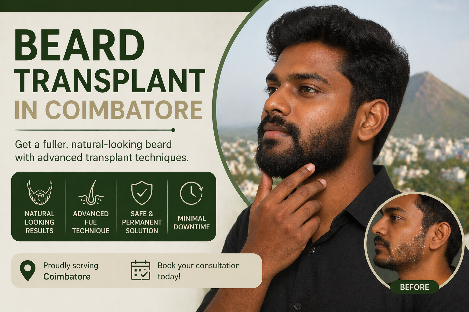 beard transplant in Coimbatore