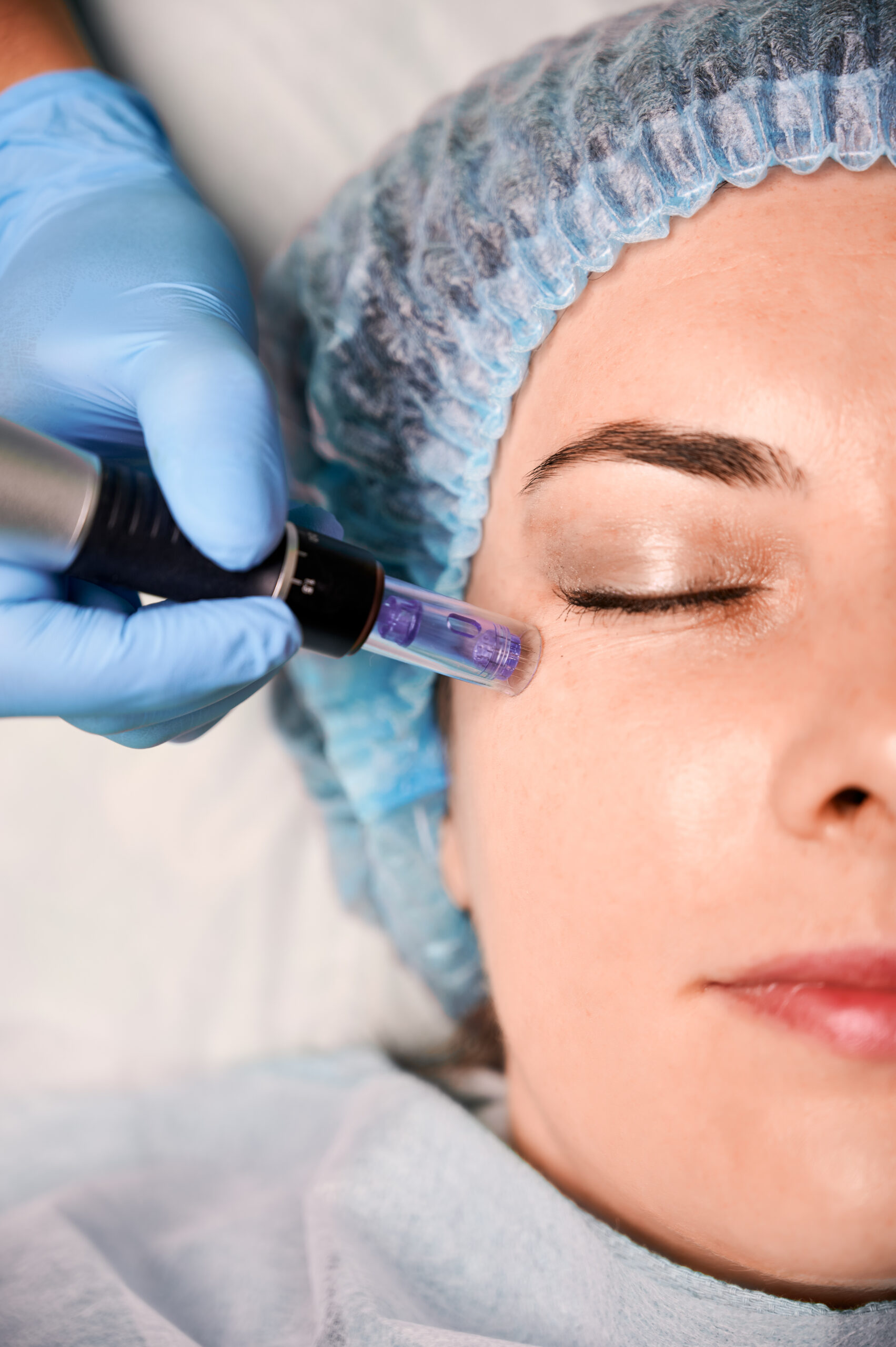 Mesotherapy