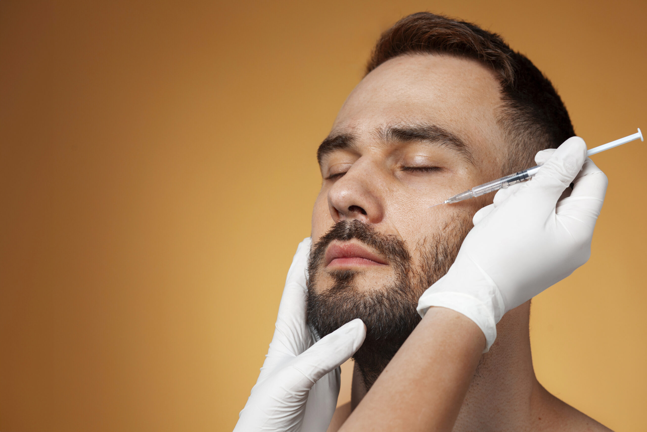 Beard Transplant