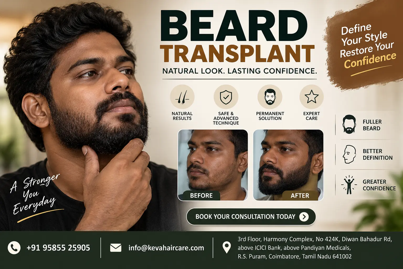 beard transplant