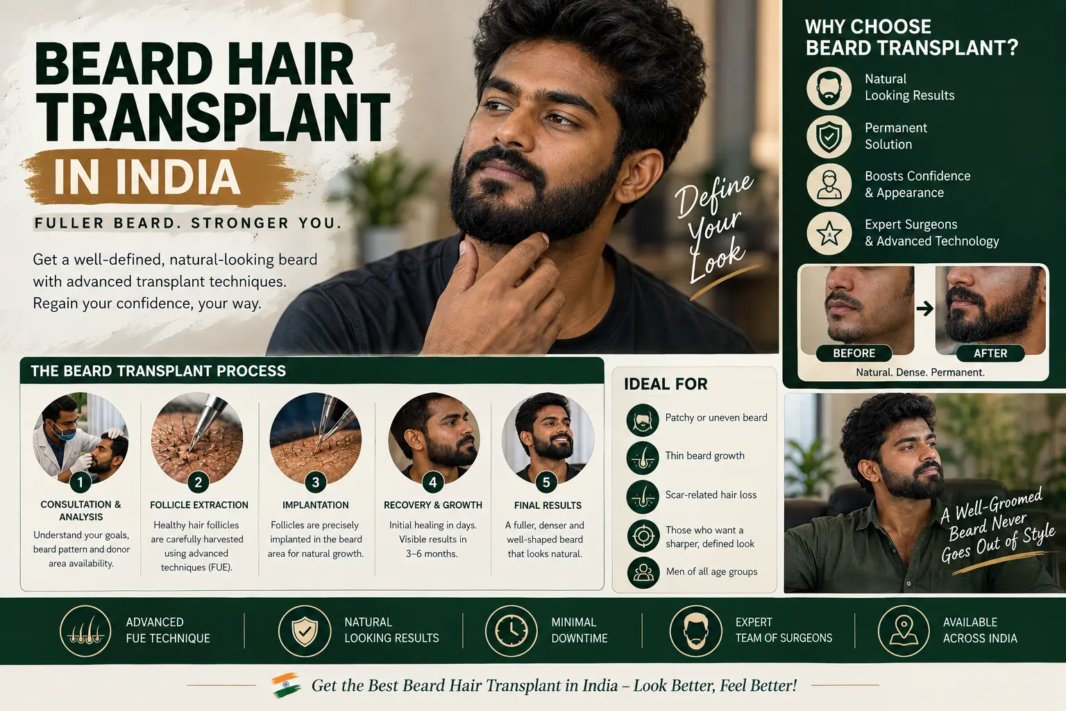 Beard Hair Transplant in India