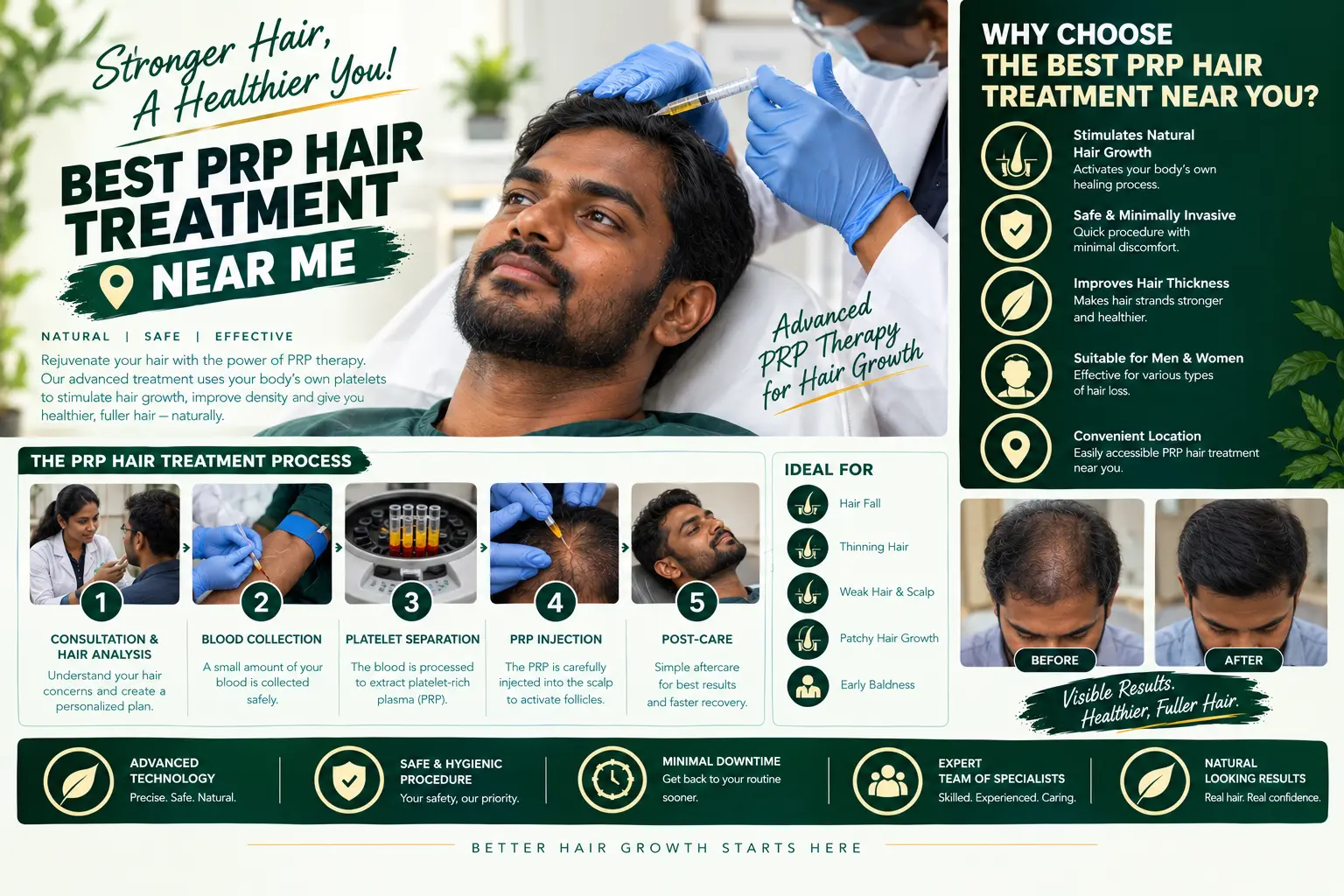 best prp hair treatment near me