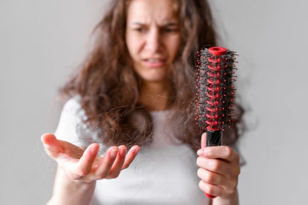 Female Hair Loss