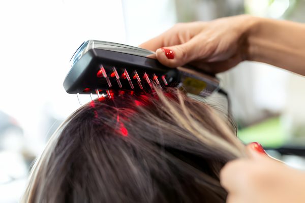 Hair Low-Level Laser Therapy (LLLT)