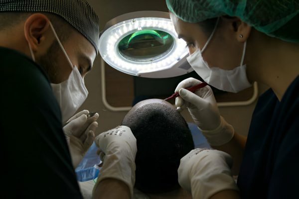 Advanced Hair Transplant Procedures